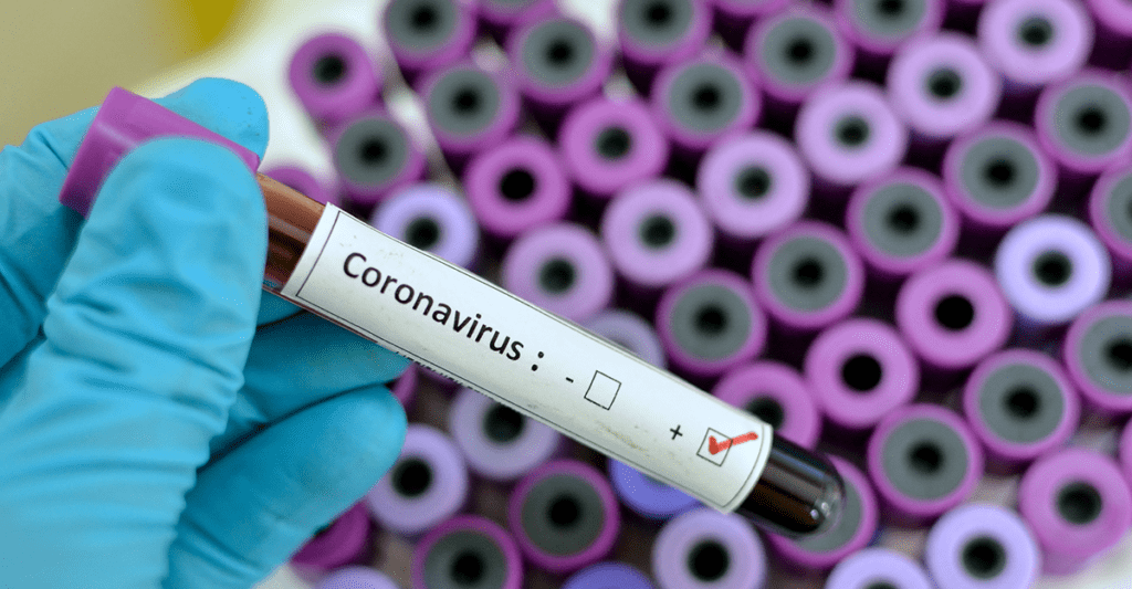 Coronavirus